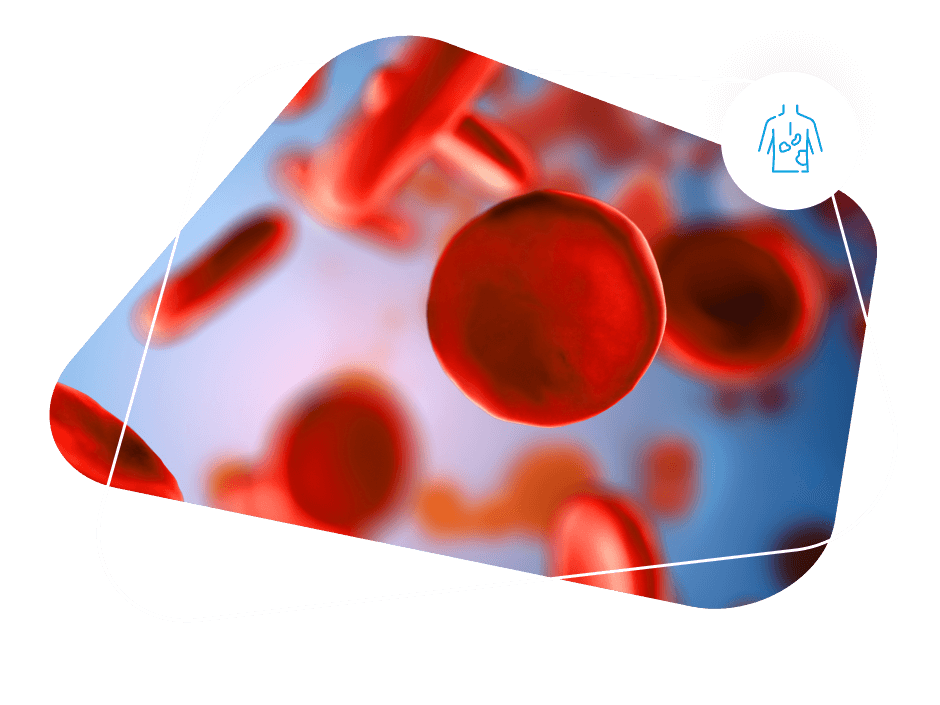 Immune Thrombocytopenia (ITP)